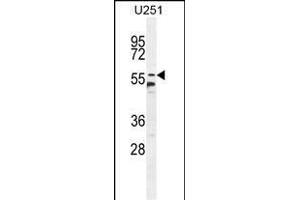 CCDC9 Antibody (N-term) (ABIN654741 and ABIN2844427) western blot analysis in  cell line lysates (35 μg/lane). (CCDC9 antibody  (N-Term))