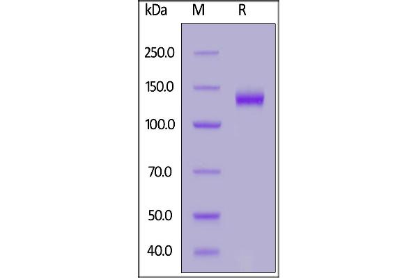 DCC Protein (AA 32-1097) (His tag)