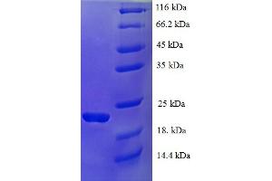 SDS-PAGE (SDS) image for Interferon, alpha 21 (IFNa21) (AA 24-189) protein (His tag) (ABIN5709715) (IFNA21 Protein (AA 24-189) (His tag))