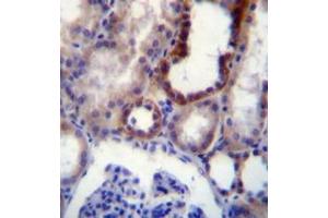 Immunohistochemistry analysis in formalin fixed and paraffin embedded (FFPE) human kidney tissue using CD316 / IGSF8 Antibody , followed by peroxidase conjugation of the secondary antibody and DAB staining. (IGSF8 antibody  (Middle Region))