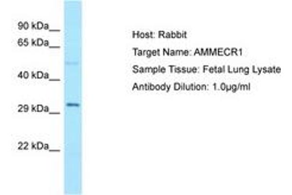 AMMECR1 antibody  (C-Term)