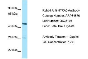 Western Blotting (WB) image for anti-HtrA Serine Peptidase 3 (HTRA3) (Middle Region) antibody (ABIN970922) (HTRA3 antibody  (Middle Region))