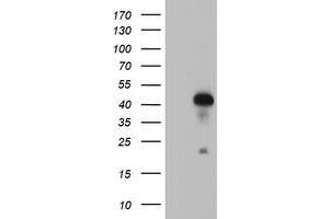 HEK293T cells were transfected with the pCMV6-ENTRY control (Left lane) or pCMV6-ENTRY RNF113B (Right lane) cDNA for 48 hrs and lysed. (RNF113B anticorps)