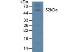 Figure. (Lipoprotein Lipase antibody  (AA 55-316))