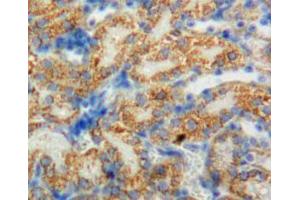 IHC-P analysis of adrenal tissue, with DAB staining. (CYP11B1 antibody  (AA 1-498))