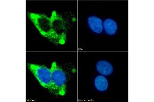 Immunofluorescence staining of fixed HepG2 cells with anti-Beta 2 adrenergic receptor antibody 13D6. (Recombinant beta 2 Adrenergic Receptor antibody)