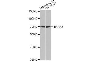 Western blot analysis of extracts of various cell lines, using TRAF3 antibody (ABIN6292132) at 1:500 dilution. (TRAF3 antibody)