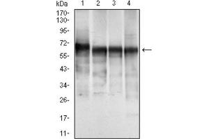 Western Blotting (WB) image for anti-Keratin 5 (KRT5) (AA 316-590) antibody (ABIN1845567) (Cytokeratin 5 antibody  (AA 316-590))
