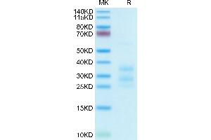 SDS-PAGE (SDS) image for CD3E & CD3G protein (His tag) (ABIN7274144)