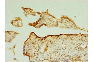 Immunohistochemistry of paraffin-embedded human placenta tissue using ABIN7171866 at dilution of 1:100 (TSPAN31 antibody  (AA 94-173))