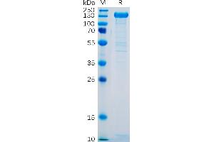 Human SELP Protein, hFc Tag on SDS-PAGE under reducing condition. (P-Selectin Protein (AA 42-771) (Fc Tag))