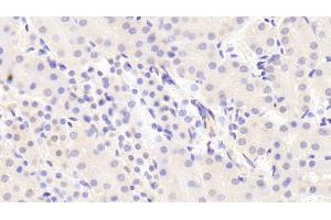 Detection of Raftlin in Mouse Kidney Tissue using Polyclonal Antibody to Raft Linking Protein (Raftlin) (RFTN1 antibody  (AA 207-451))