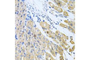 Immunohistochemistry of paraffin-embedded mouse stomach using CASP9 antibody at dilution of 1:100 (x40 lens). (Caspase 9 antibody)