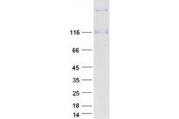 COL21A1 Protein (Myc-DYKDDDDK Tag)