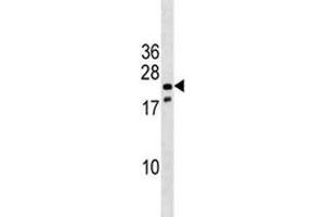 Nkx3. (NKX3-1 antibody  (AA 3-1))