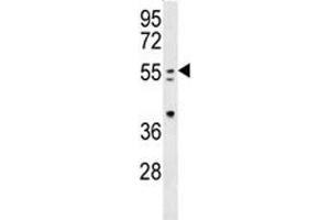 PAX-7 antibody western blot analysis in mouse spleen tissue lysate (PAX7 antibody  (AA 410-437))