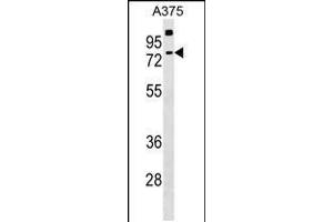 Western blot analysis in A375 cell line lysates (35ug/lane). (TKTL2 antibody  (N-Term))