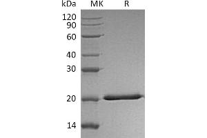 Greater than 95 % as determined by reducing SDS-PAGE. (IL28A Protein (His tag))