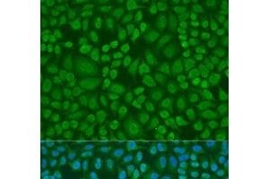 Immunofluorescence analysis of U2OS cells using DROSHA Polyclonal Antibody at dilution of 1:100. (DROSHA antibody)