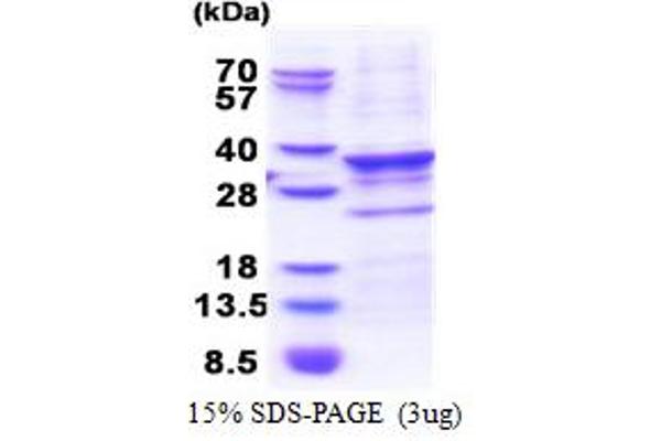 CENPQ Protein (AA 1-268) (His tag)