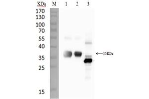 WB 1:1000, 12% SDS-PAGE. (SARS-CoV-2 Spike S1 antibody  (RBD))