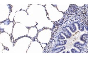 Detection of PSME3 in Human Lung Tissue using Polyclonal Antibody to Proteasome Activator Subunit 3 (PSME3) (PSME3 antibody  (AA 7-254))