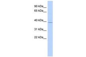 Image no. 1 for anti-Magnesium Transporter 1 (MAGT1) (AA 35-84) antibody (ABIN6744305) (MAGT1 antibody  (AA 35-84))