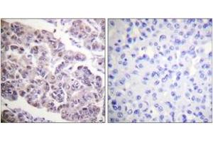 Immunohistochemistry (IHC) image for anti-Histone H4 (acLys12) antibody (ABIN2890734) (Histone H4 antibody  (acLys12))