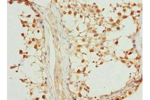Immunohistochemistry of paraffin-embedded human testis tissue using ABIN7169217 at dilution of 1:100 (VRK1 antibody  (AA 257-396))