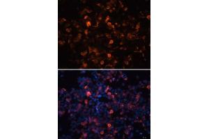 Immunofluorescence analysis of 293T cells using Mouse anti His-Tag mAb. (His Tag antibody)