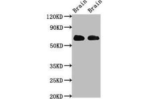 Western Blot Positive WB detected in: Rat brain tissue, Mouse brain tissue All lanes: SLC1A2 antibody at 3. (SLC1A2 antibody  (AA 460-574))