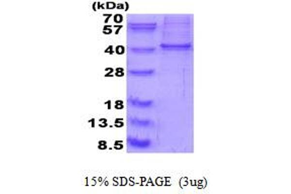 Raly Protein (AA 1-306) (His tag)