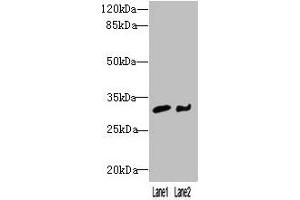 Western blot All lanes: NIT2 antibody at 3 μg/mL Lane 1: Mouse heart tissue Lane 2: A549 whole cell lysate Secondary Goat polyclonal to rabbit IgG at 1/10000 dilution Predicted band size: 31 kDa Observed band size: 31 kDa (NIT2 antibody  (AA 1-276))