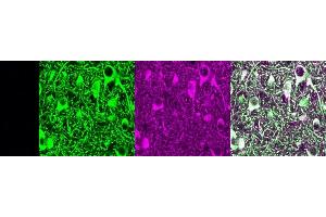 Immunohistochemistry (IHC) image for anti-Microtubule-Associated Protein 2 (MAP2) antibody (ABIN7456022) (MAP2 antibody)