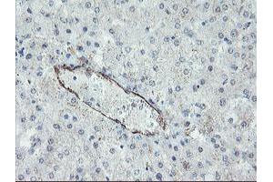 Immunohistochemistry (IHC) image for anti-Platelet/endothelial Cell Adhesion Molecule (PECAM1) antibody (ABIN1497250) (CD31 antibody)