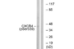 Immunohistochemistry analysis of paraffin-embedded human brain carcinoma tissue using CXCR4 (Phospho-Ser339) antibody. (CXCR4 antibody  (pSer339))