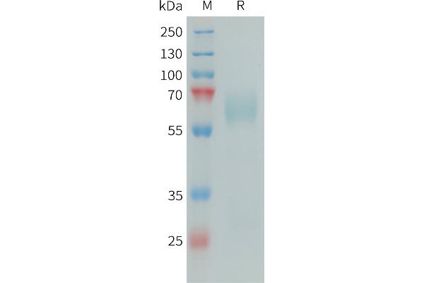 APCS Protein (AA 17-524) (His tag)