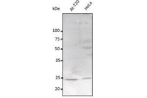 Anti-Rab11a Ab at 1/2,500 dilution, Iysates at 100 µg per Ilane, rabbit poIycIonaI to goat IgG(HRP) at 1/10,000 dilution, (RAB11A antibody  (C-Term))