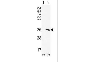 Western blot analysis of NAT2 using rabbit polyclonal NAT2 Antibody using 293 cell lysates (2 ug/lane) either nontransfected (Lane 1) or transiently transfected (Lane 2) with the NAT2 gene. (NAT2 antibody  (C-Term))