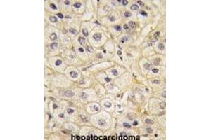 Immunohistochemistry (IHC) image for anti-G Protein-Coupled Receptor Kinase 1 (GRK1) antibody (ABIN3002923) (GRK1 antibody)