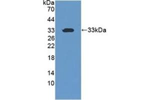 Detection of Recombinant CIDEC, Human using Polyclonal Antibody to Cell Death Inducing DFFA Like Effector C (CIDEC) (CIDEC antibody  (AA 1-251))