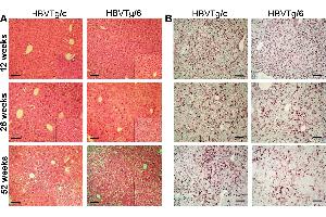 Paraffin-embedded sections of transgenic mice liver were stained with an antibody against HBsAg (ABIN285516). (HBSAg antibody)