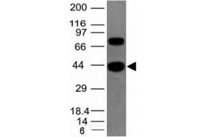 Western blot of human SKM tissue lysate using pan Muscle Actin antibody (Pan Muscle Actin antibody)