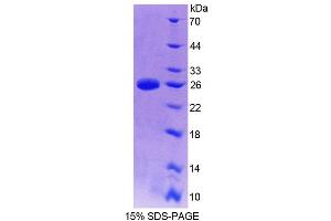 SDS-PAGE (SDS) image for Suppressor of Cytokine Signaling 2 (SOCS2) (AA 1-198) protein (His tag) (ABIN4990669) (SOCS2 Protein (AA 1-198) (His tag))