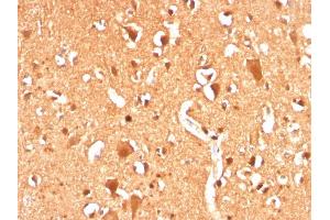 Formalin-fixed, paraffin-embedded human Brain stained with Ubiquitin Recombinant Rabbit Monoclonal Antibody (UBB/3143R). (Recombinant Ubiquitin B antibody  (AA 1-119))