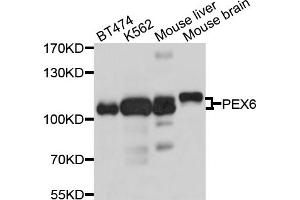 Western blot analysis of extracts of various cell lines, using PEX6 antibody. (PEX6 antibody)