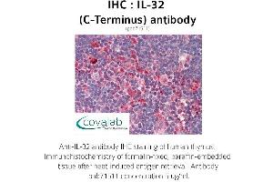 Image no. 1 for anti-Interleukin 32 (IL32) antibody (ABIN1735884) (IL32 antibody)