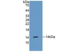 Detection of Recombinant OSM, Mouse using Polyclonal Antibody to Oncostatin M (OSM) (Oncostatin M antibody  (AA 116-205))