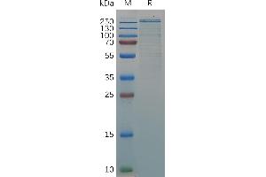 Human VWF (23-2813) Protein, His Tag on SDS-PAGE under reducing condition. (VWF Protein (AA 23-2813) (His tag))