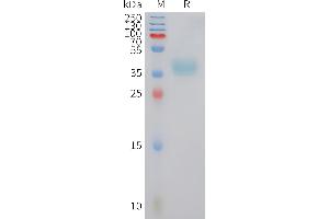 XCR1 Protein (AA 1-31) (Fc Tag)